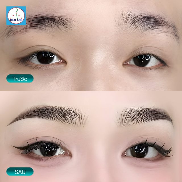 Chân mày thưa nên làm gì?