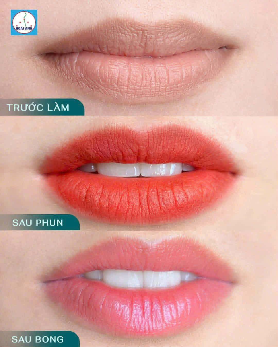 Ba giai đoạn phun môi tại Hoài Anh: trước làm, ngay sau phun và sau khi bong