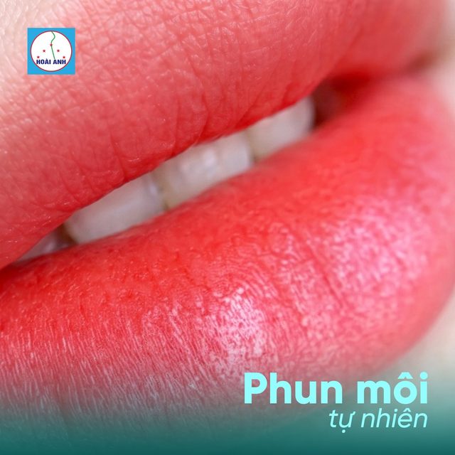 Phun môi tại Hoài Anh