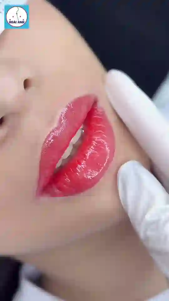 Phun môi khử thâm — từ môi thâm sang sắc hồng tươi