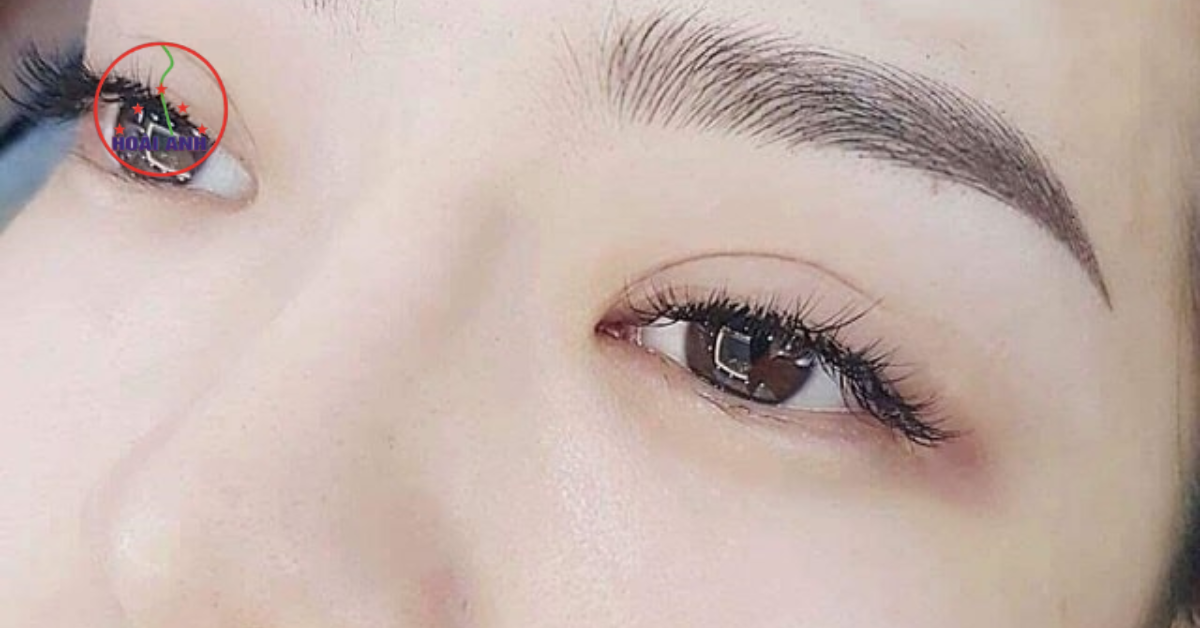 Điêu khắc chân mày tại Thẩm mỹ viện Hoài Anh