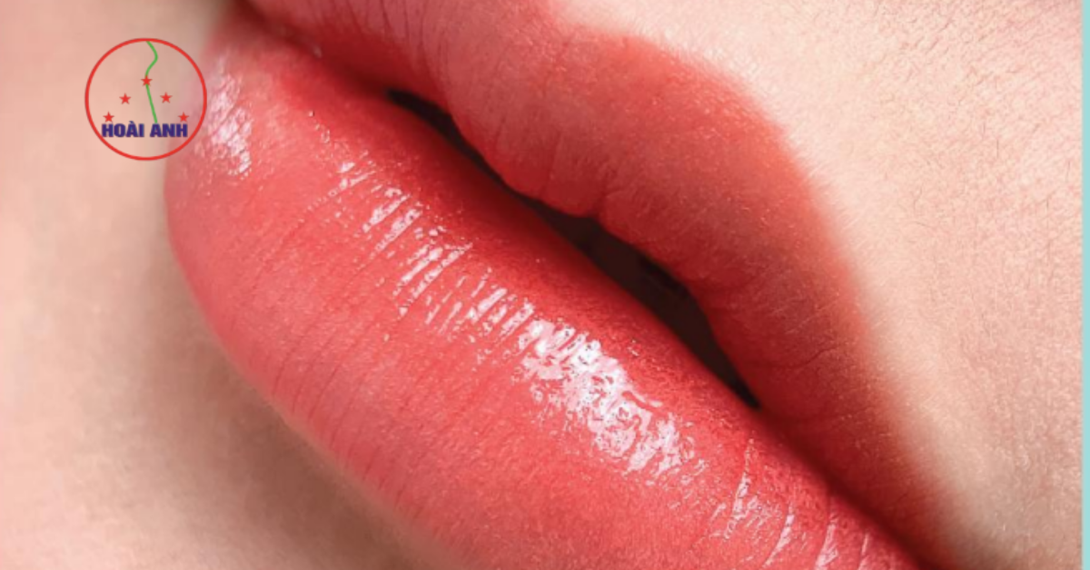 phun môi collagen tế bào gốc tự nhiên