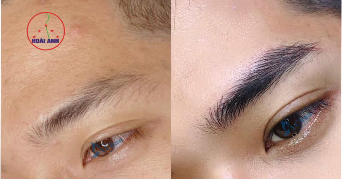 điêu khắc chân mày nam đẹp tự nhiên uy tín