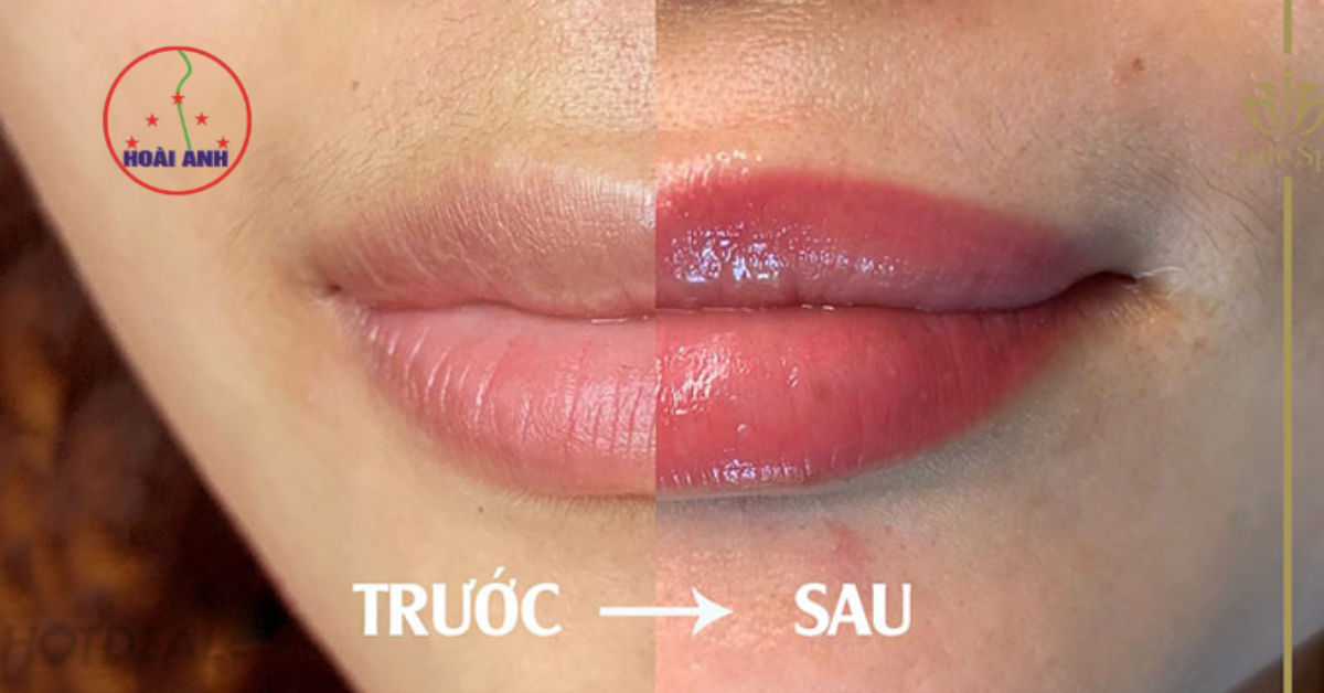 dịch vụ phun môi tự nhiên