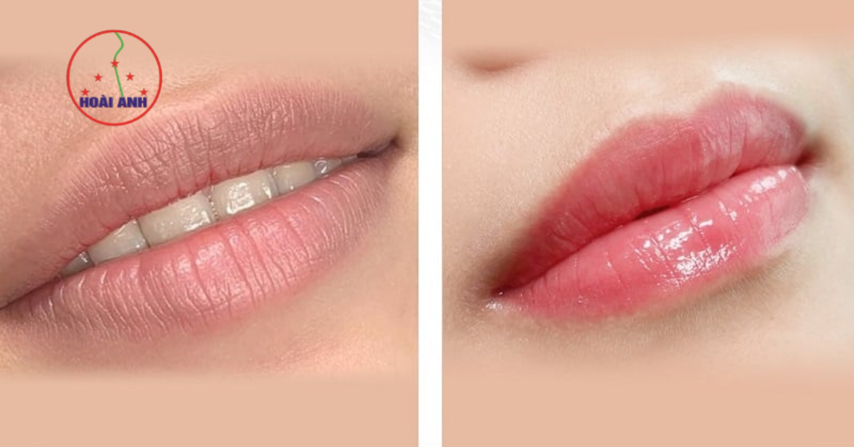 phun môi trị thâm tự nhiên giá rẻ