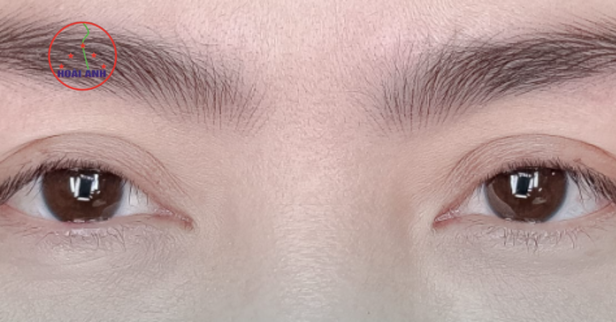 Kết quả xăm chân mày nam Hoài Anh