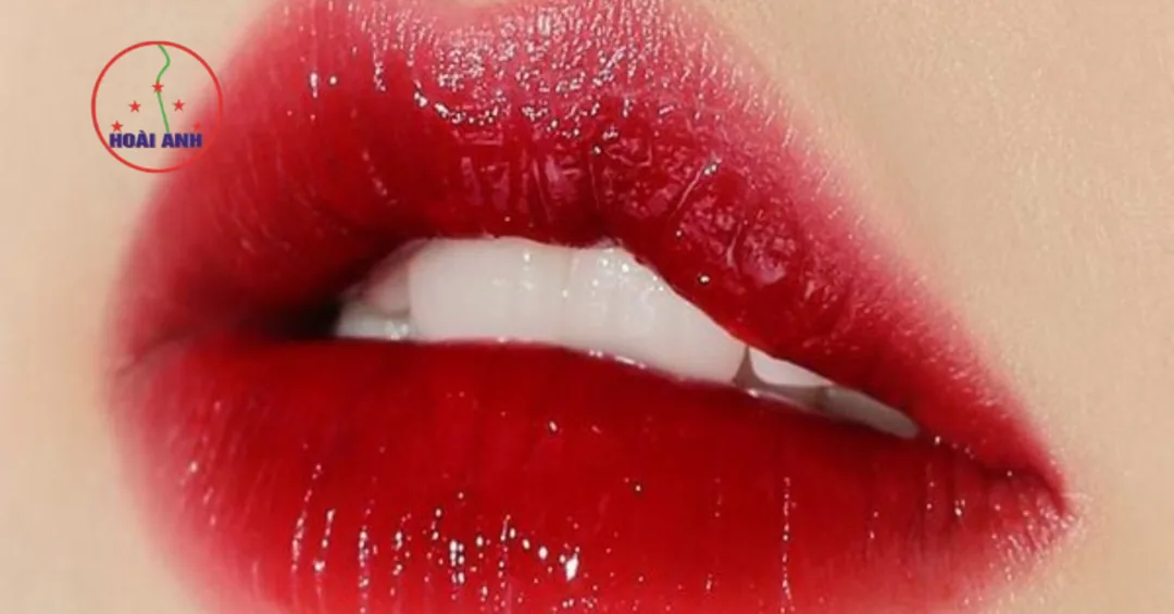 Kết quả phun môi đỏ cherry Hoài Anh