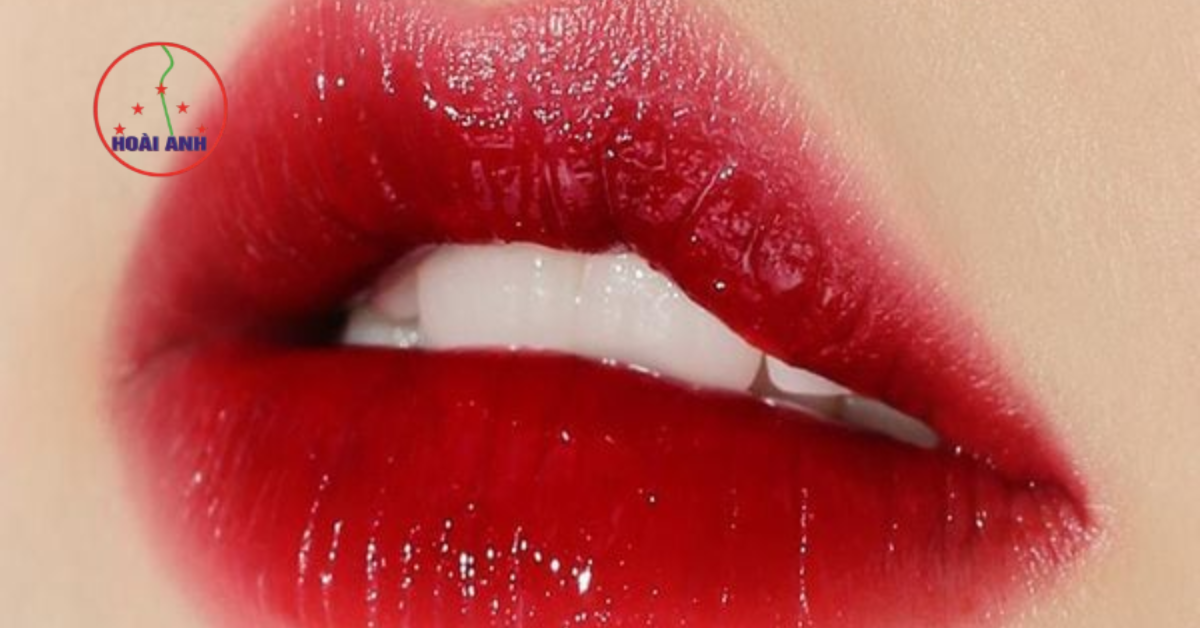 Kết quả phun môi đỏ cherry Hoài Anh
