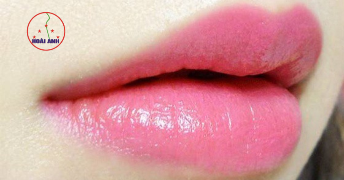 Môi hồng baby căng mọng nhẹ nhàng