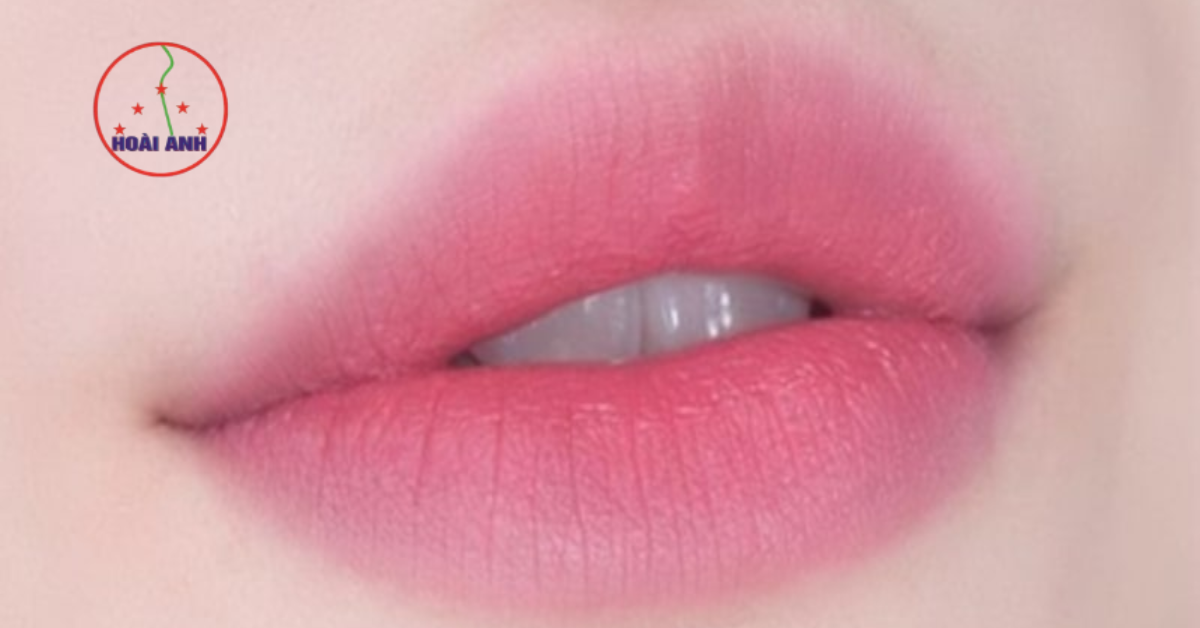 Kết quả phun môi hồng baby Hoài Anh