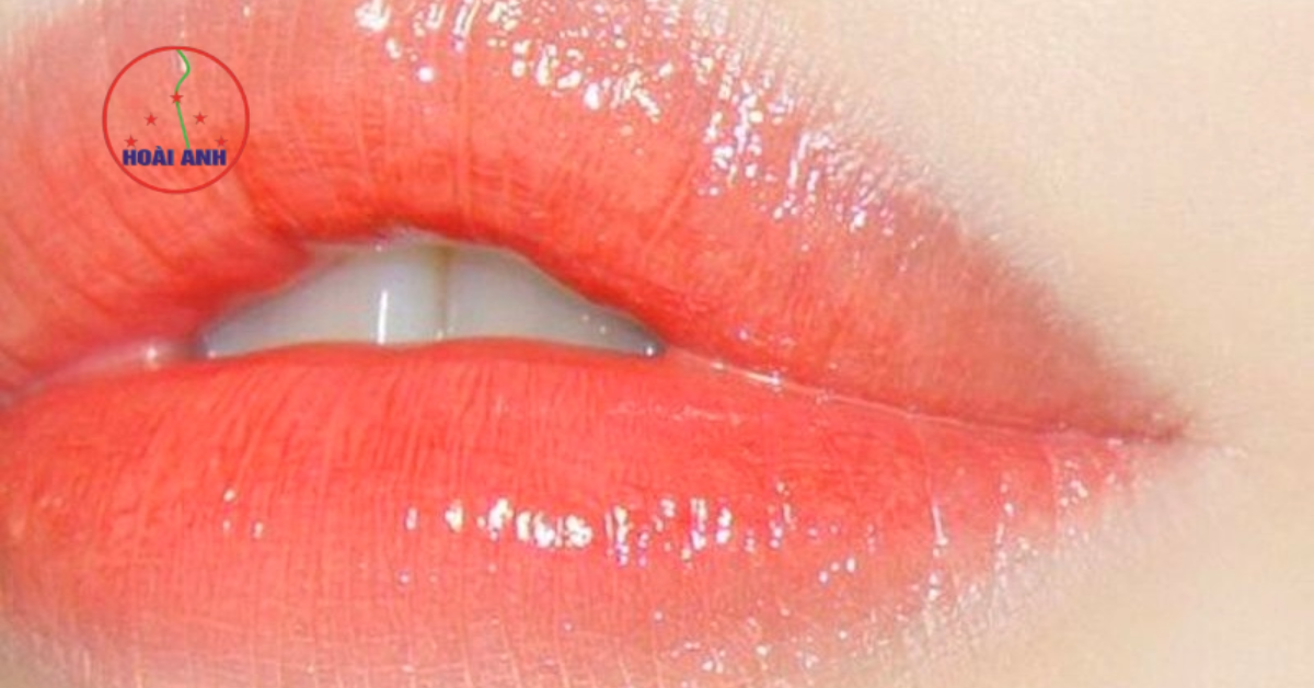 Kết quả phun môi cam san hô Hoài Anh