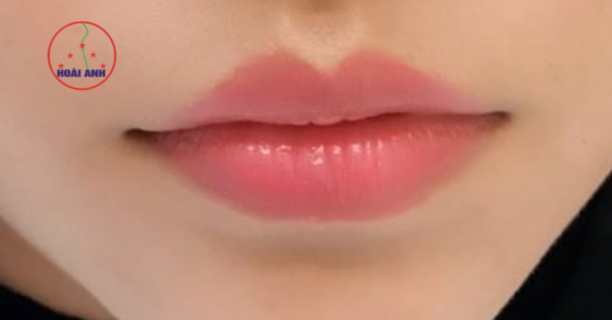 phun môi tại Hoài Anh