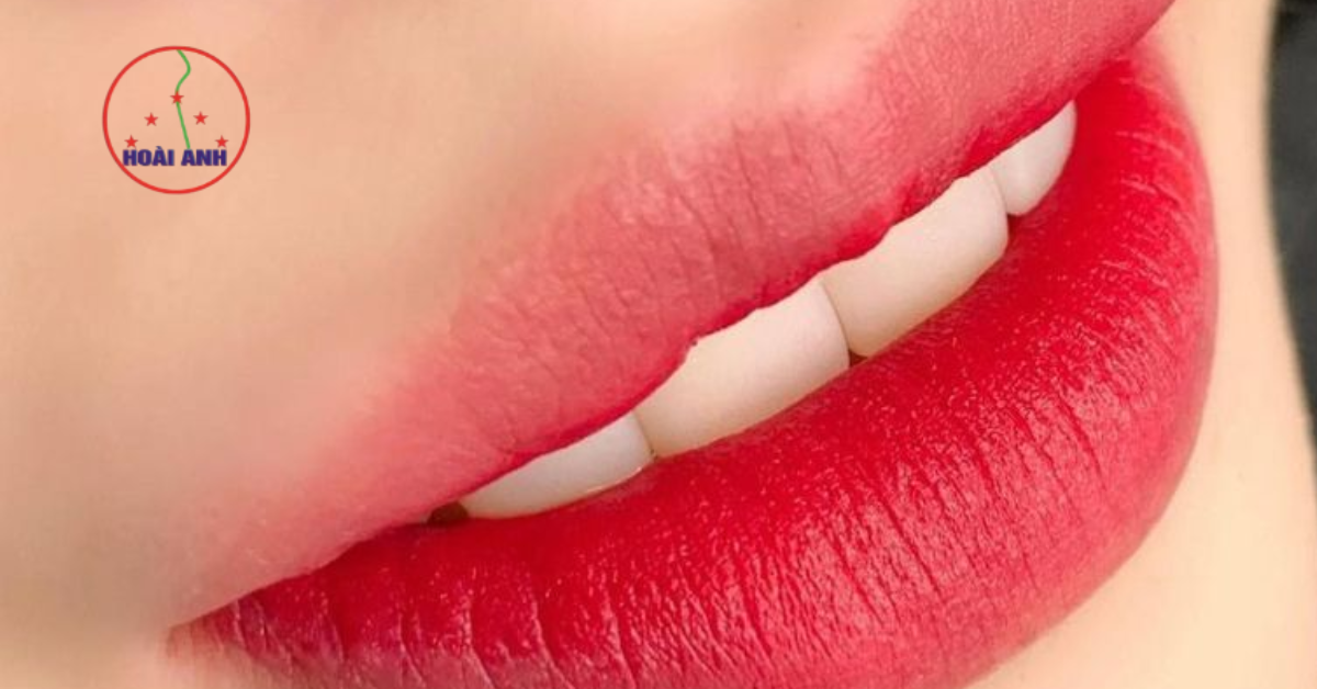 Kết quả phun môi tại Hoài Anh
