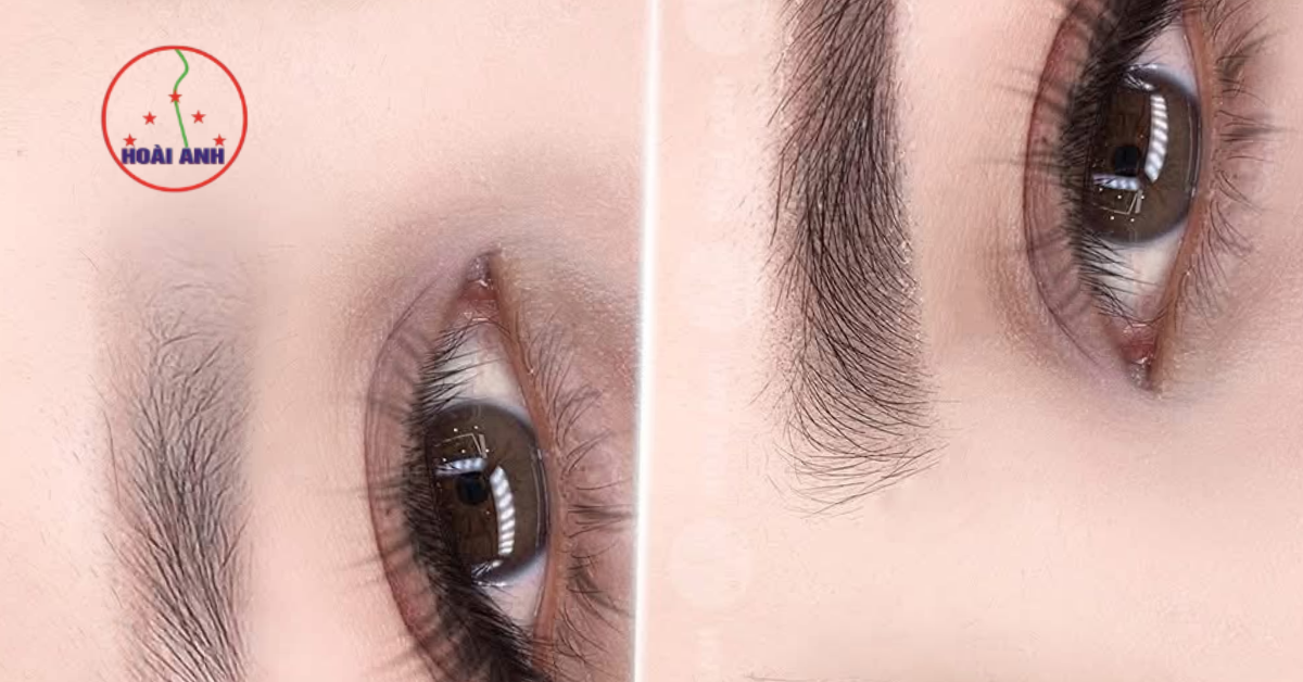 Chi phí phun mày phụ thuộc công nghệ