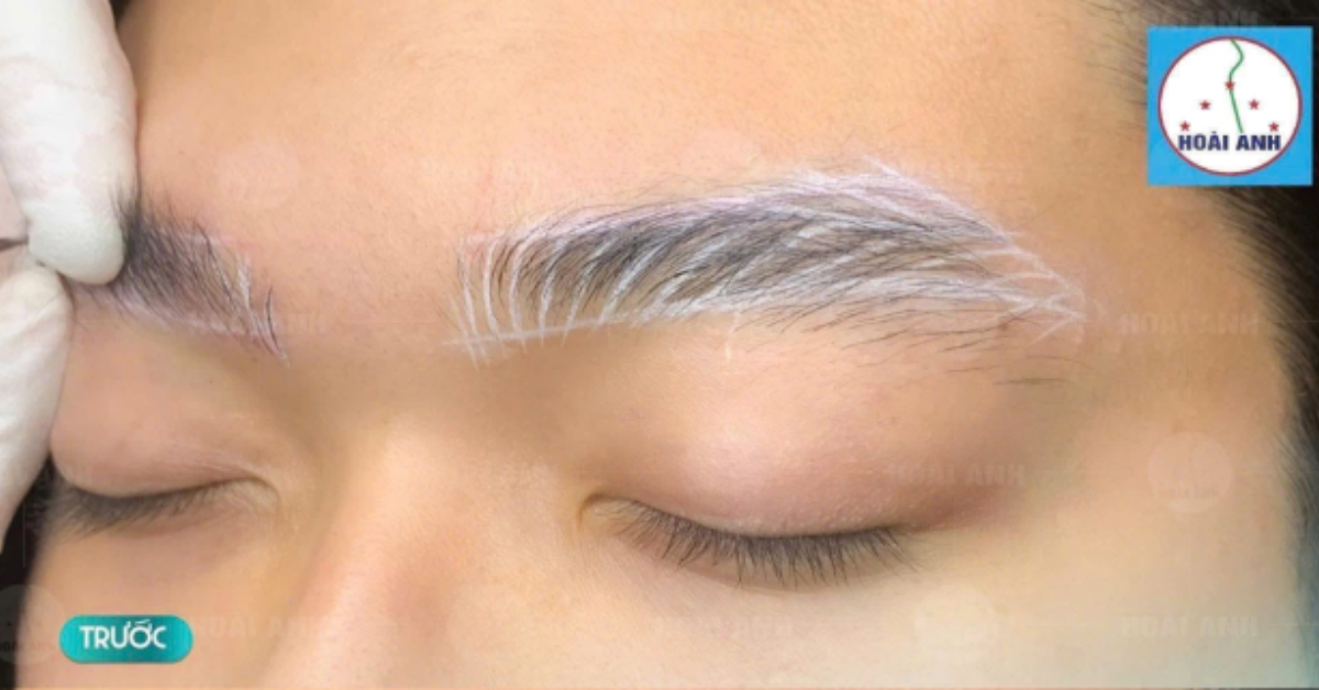 Phun mày nam tự nhiên tại thẩm mỹ Hoài Anh