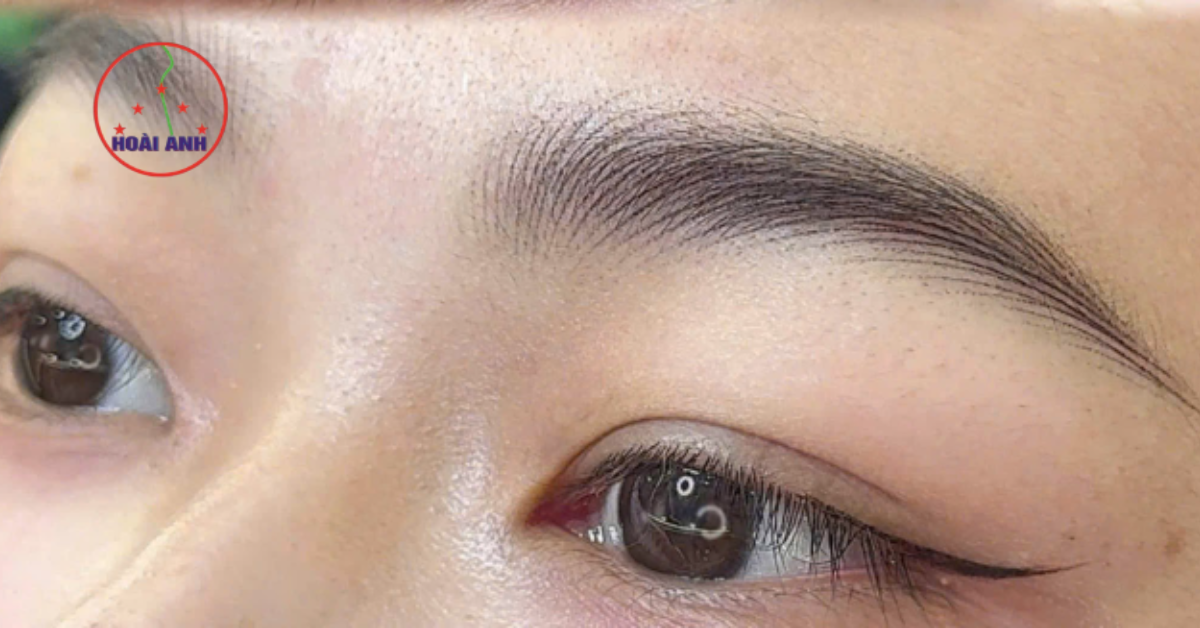 Chỉnh sửa chân mày hỏng lấy lại dáng đẹp