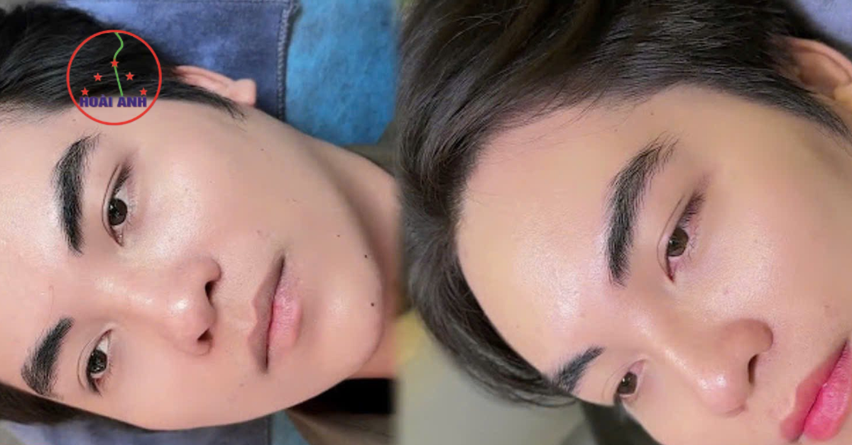 Khắc phục chân mày lệch và màu không đẹp