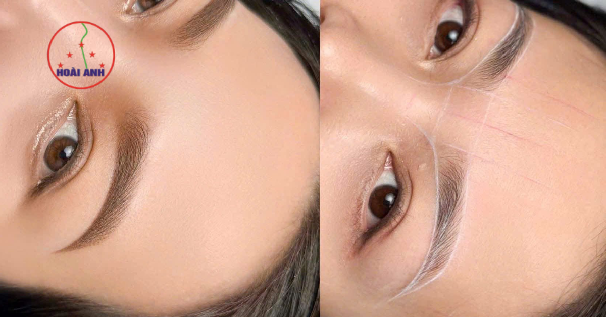 Chân mày hỏng được chỉnh sửa tự nhiên hơn