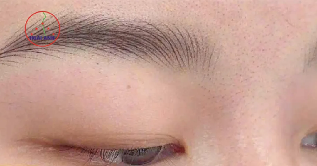 Dịch vụ sửa chân mày hỏng tại Hoài Anh