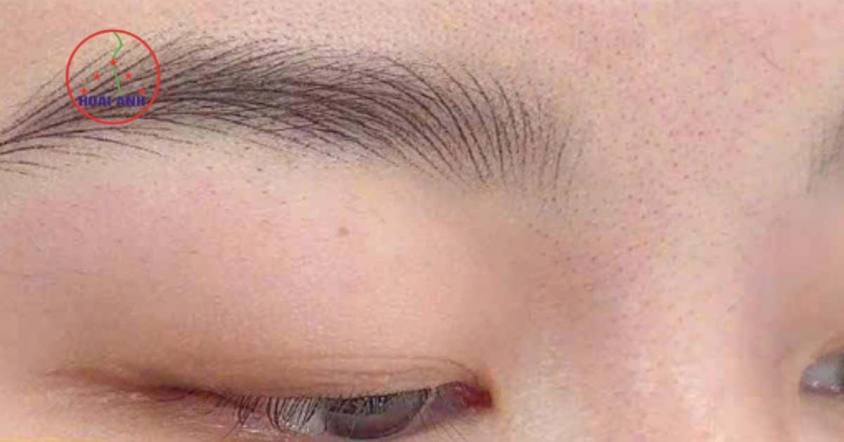 Dịch vụ sửa chân mày hỏng tại Hoài Anh