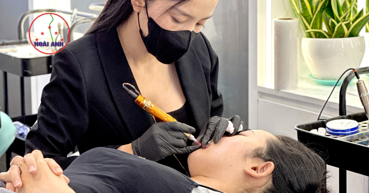 thẩm mĩ viện hoài anh 25 năm kinh nghiệm uy tín