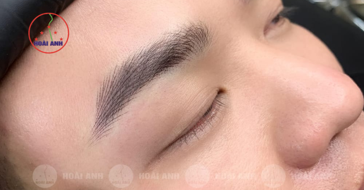 Phun mày nam tự nhiên tại thẩm mỹ Hoài Anh