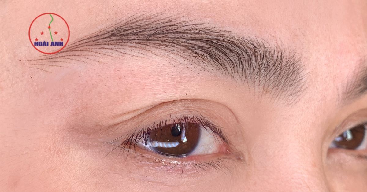 Chân mày thưa nên làm gì để cải thiện vẻ ngoài tự nhiên?