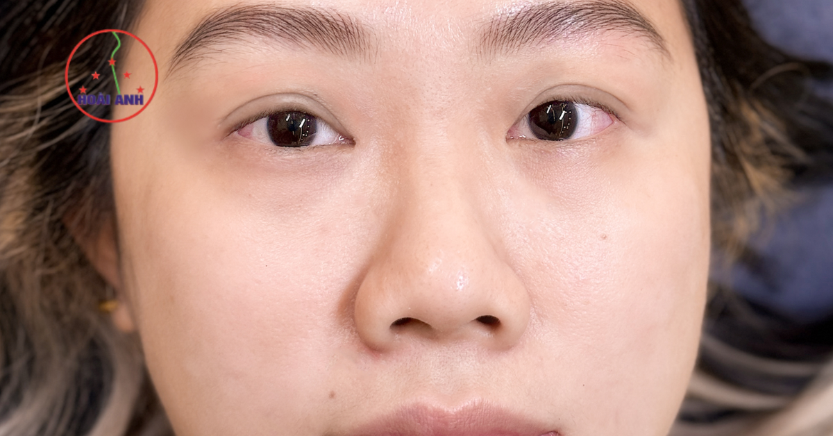 Chân mày thưa nên làm gì nếu muốn đẹp lâu dài, bền màu?