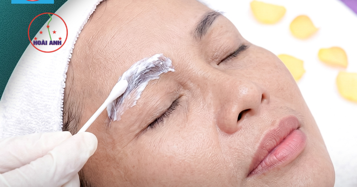 Vệ sinh và ủ tê khi phun mày tại TMV Hoài Anh