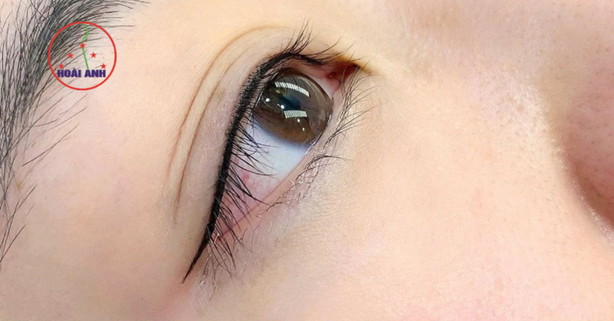 Phun mí mở tròng giúp mắt to tự nhiên
