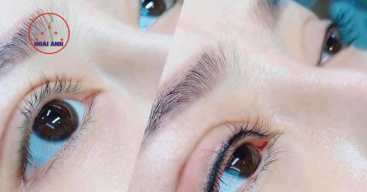 Đôi mắt cuốn hút hơn nhờ phun mí