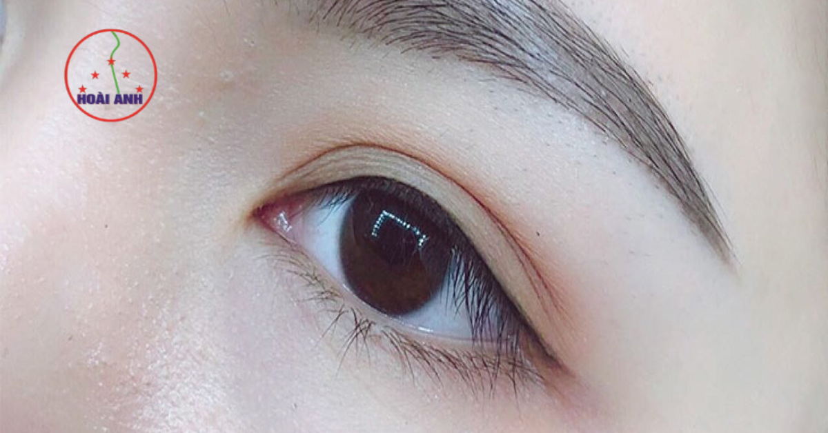 Kỹ thuật phun mí eyeliner đẹp tại Hoài Anh