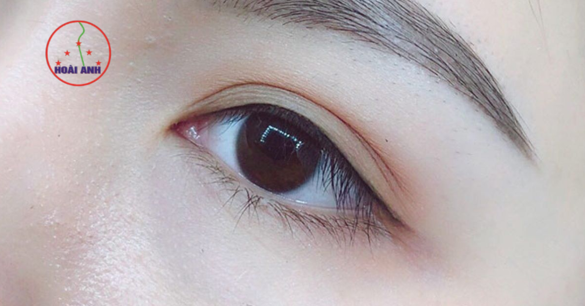 Phun mí collagen bền đẹp, không lo xuống màu