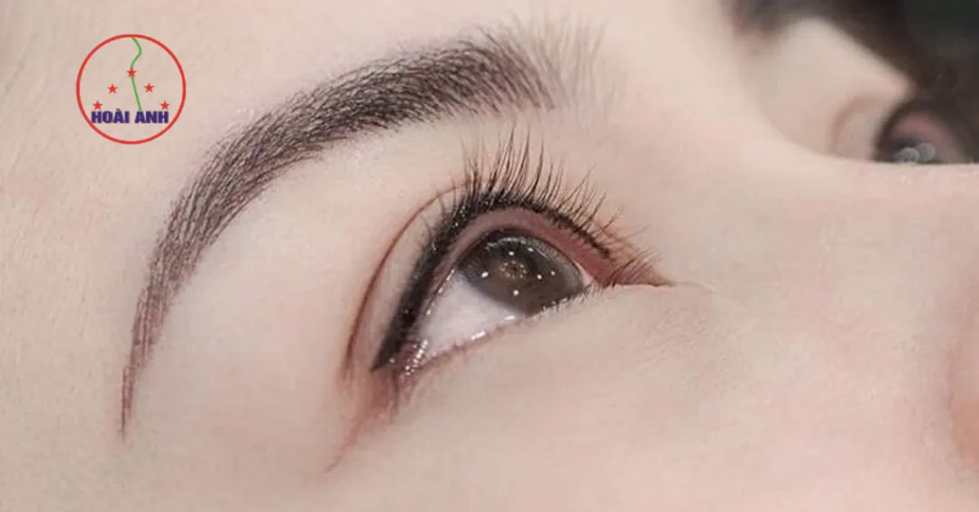 Phun mí vi chạm giúp mắt rõ nét tự nhiên