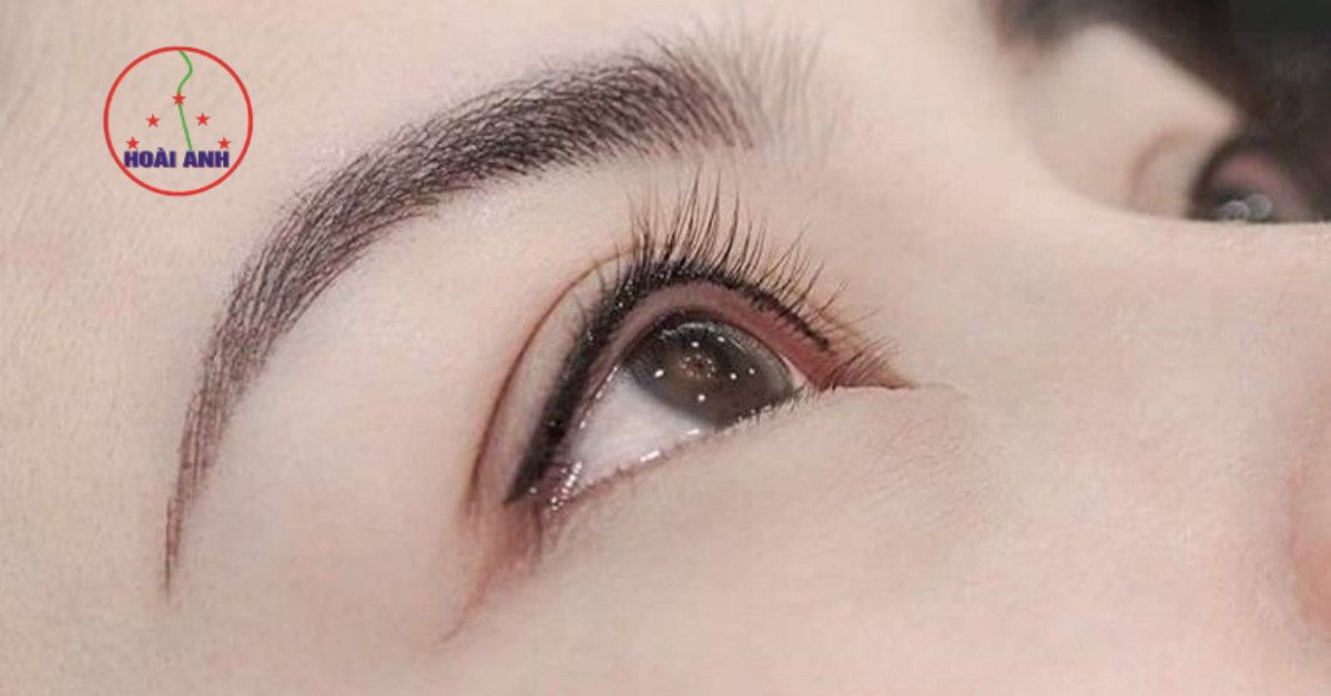 Phun mí vi chạm giúp mắt rõ nét tự nhiên