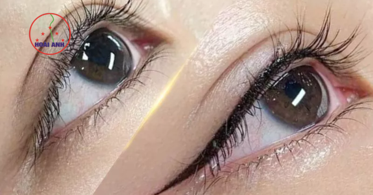 Đôi mắt cuốn hút hơn với phun mí vi chạm