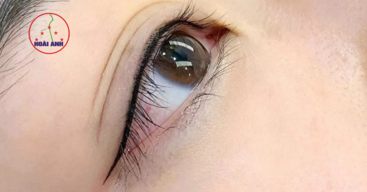 Kỹ thuật phun mí vi chạm đẹp tại Hoài Anh