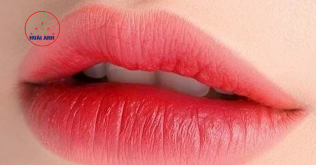 Phun môi nano tại Hoài Anh ưu tiên vẻ đẹp tự nhiên 