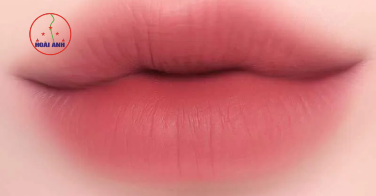 Phun môi vi chạm là giải pháp làm đẹp 