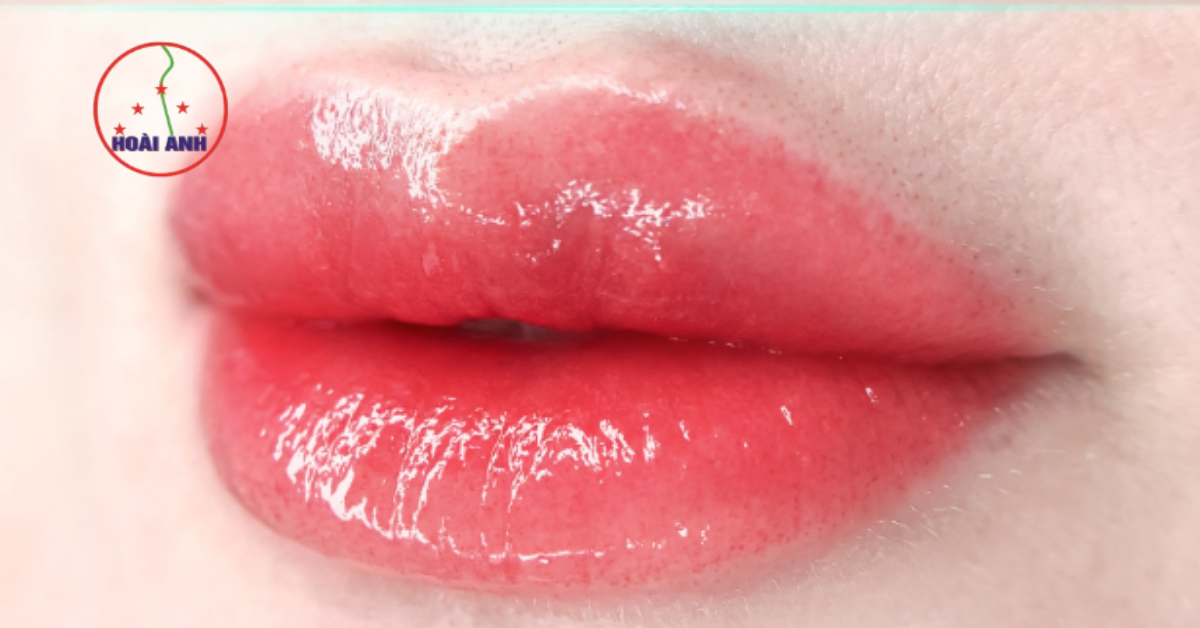 Phun môi vi chạm tại Hoài Anh ưu tiên vẻ đẹp tự nhiên