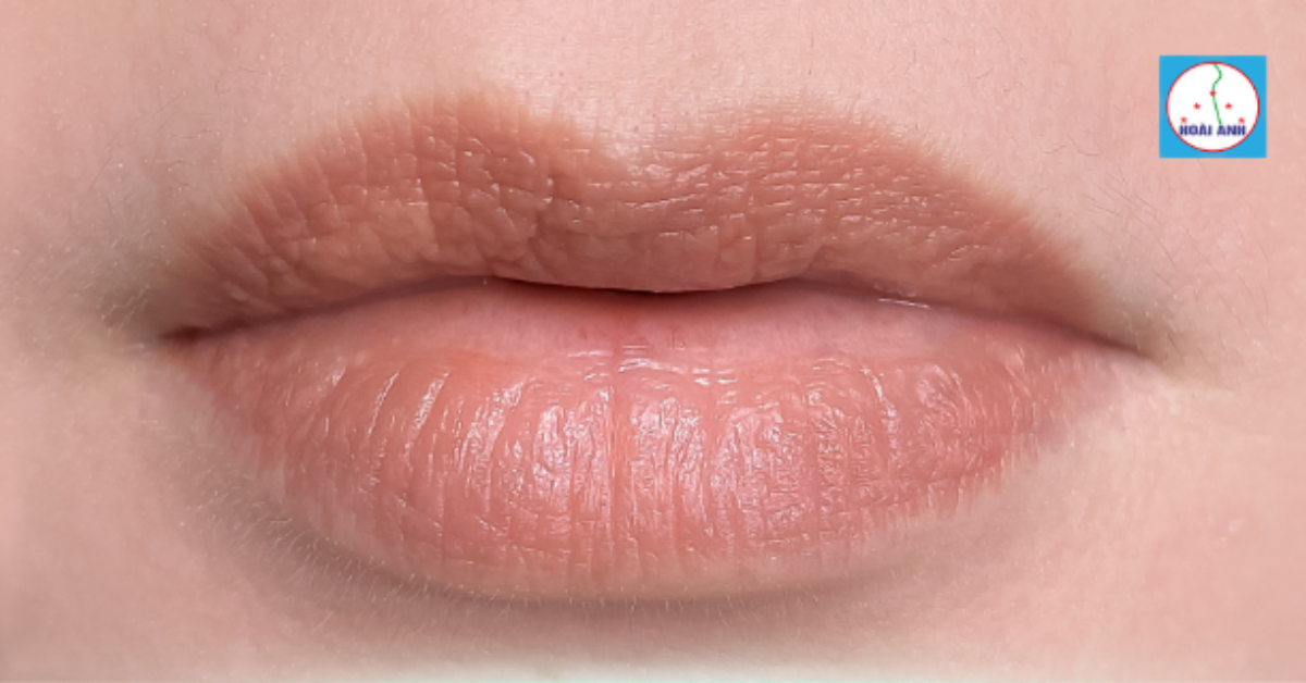 Đôi môi trước khi phun