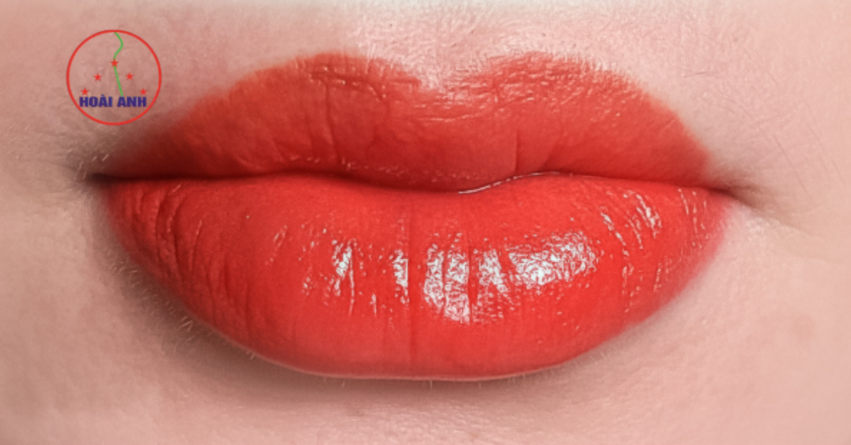 Đôi môi sau khi khử thâm