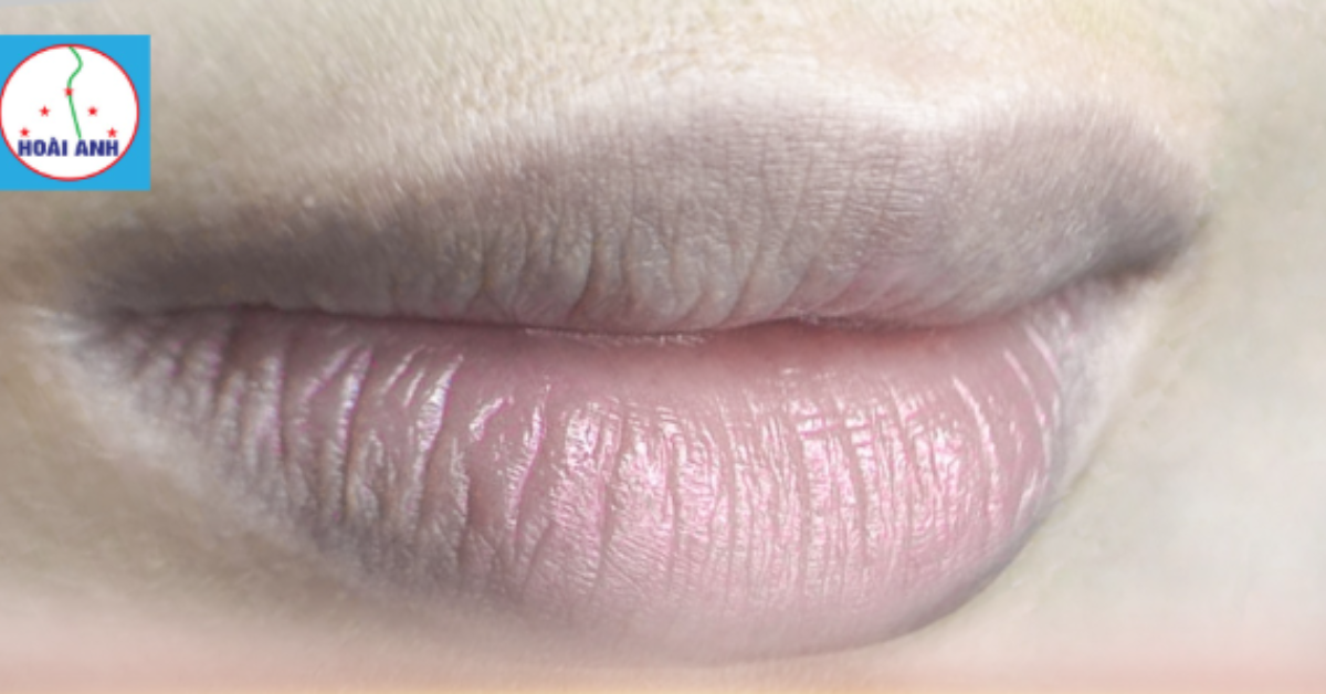 Phun môi khử thâm giúp cải thiện sắc môi xỉn màu