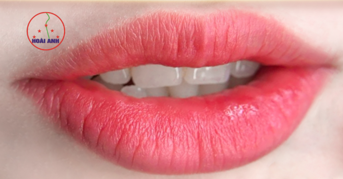 phun môi khử thâm tại Hoài Anh ưu