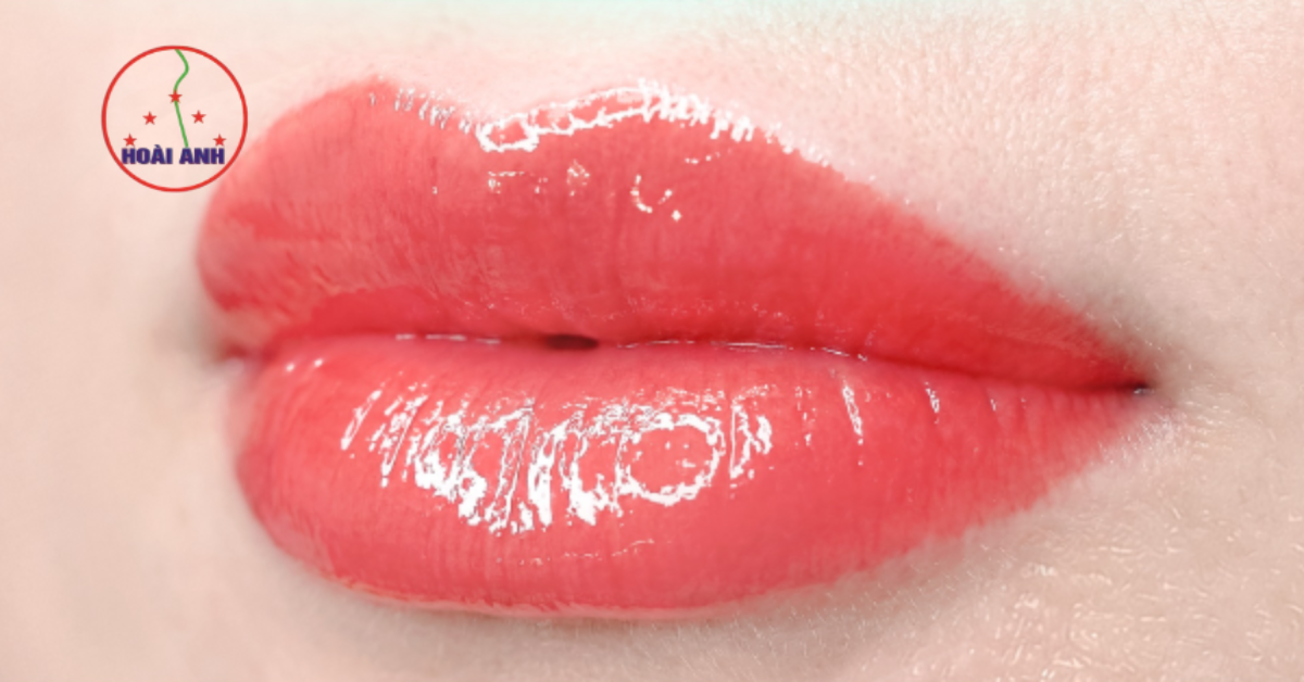 Đôi môi sau khi xử lý thâm tại MTV Hoài Anh