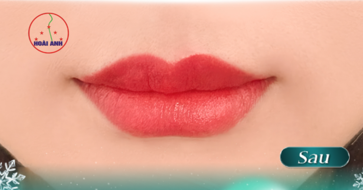 Đôi môi sau khi phun tại TMV Hoài Anh