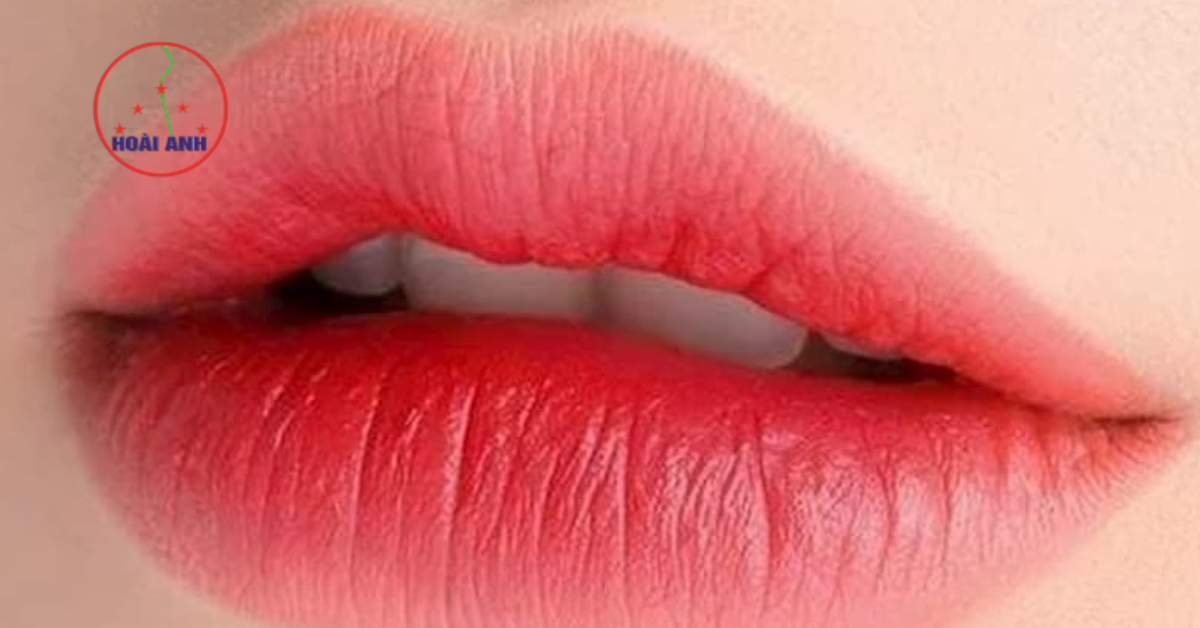 Phun môi collagen có đau không là thắc mắc phổ biến của nhiều khách hàng 