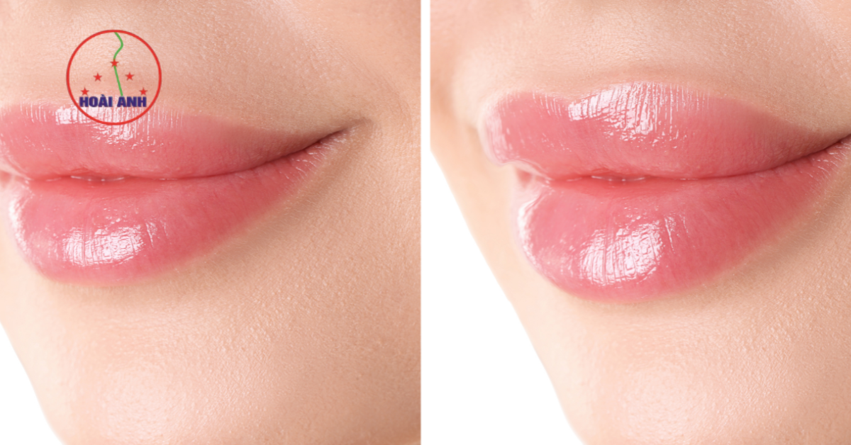 chăm sóc sau phun môi lên màu đẹp tự nhiên, bền màu lâu phai