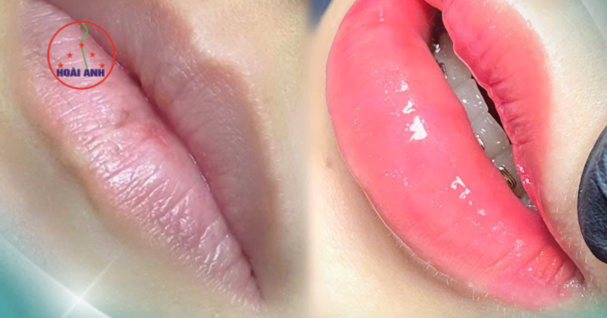 Đôi môi cuốn hút hơn với phun môi phủ bóng