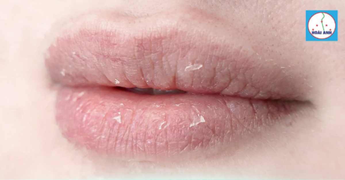 môi chưa phủ bóng đẹp